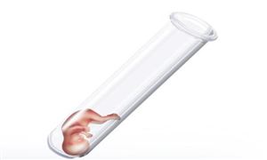 2022中國輔助生殖行業(yè)分析及發(fā)展