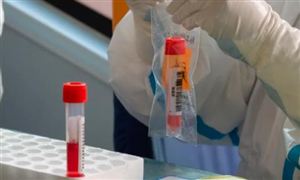 多地通知11月起核酸檢測要收費(fèi) 新冠疫情推動分子診斷市場爆發(fā)性增長