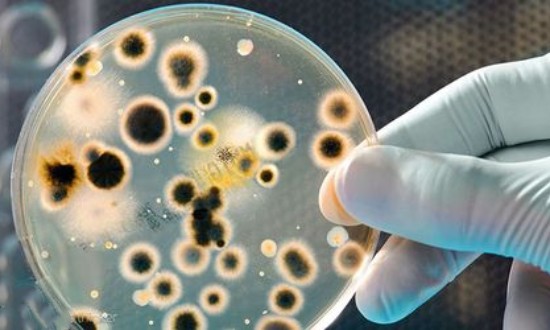 2024年中國微生物技術(shù)行業(yè)的產(chǎn)業(yè)鏈結(jié)構(gòu)及投資機(jī)會(huì)分析